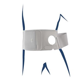 Stomacare Bandage EasyOpener Plus, Höhe 15cm | S3157204R-M | PZN 17905662