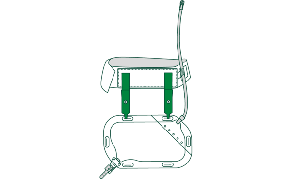 Sauer-NephSys-Gurtset Comfort